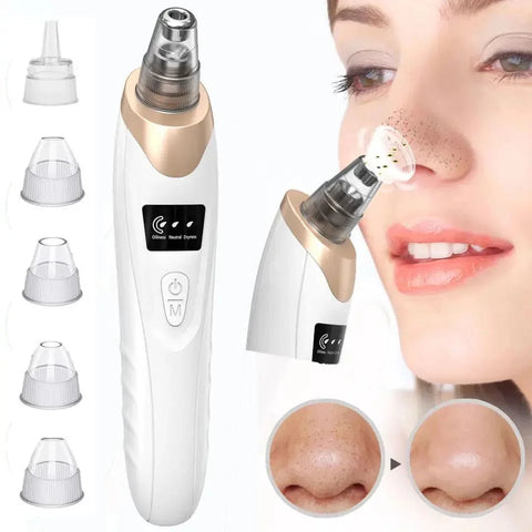 Electric blackhead removers
